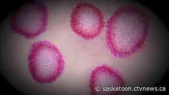 Saskatoon research lab gets $200000 to find COVID-19 vaccine - CTV News