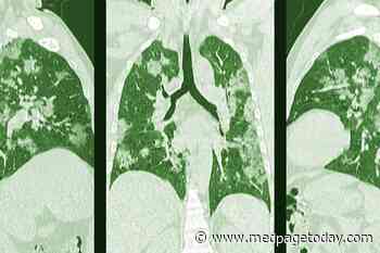 3 COVID-19 Cases as Described by Doctors in Wuhan