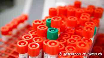 Gatherings of 250 people or more banned in Sask. as second presumptive COVID-19 case confirmed