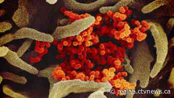 Sask. detects 2nd presumptive COVID-19 case