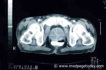 'MultiD': Taking the Bias Out of Prostate Cancer Tx