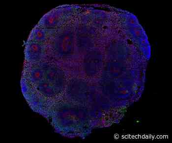 The Epidemic Outbreak of the Zika Virus Was Bad – Something in the Water Made It Worse