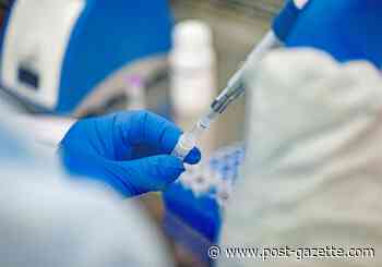 UPMC develops COVID-19 virus test; plans to start select specimen collection next week