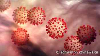 10 new coronavirus cases in Alberta, 2 in intensive care