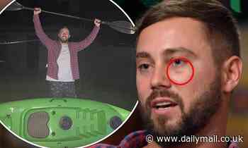 Married At First Sight: Josh Pihlak bizarre  explanation behind mystery black eye