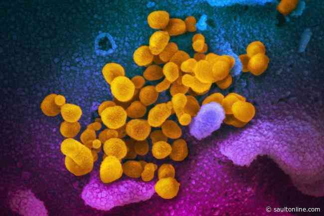 Health officials explain why not everyone can get swabbed for COVID-19 right now