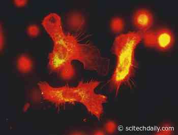 Newly Discovered Memory in Our Bones: Keeping a Record of Previous Infections to Boost Immunity