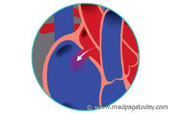 Transcatheter Approach to Heart Defect: The Next Level?
