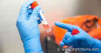 Confirmed number of Minnesota coronavirus cases rises to 77, while testing to decline