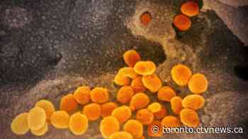 At least 20 new cases cases of COVID-19 confirmed in Ontario, bringing provincial total to 211