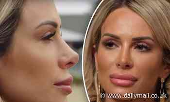 Married At First Sight: Stacey Hampton on why her lips keep getting bigger