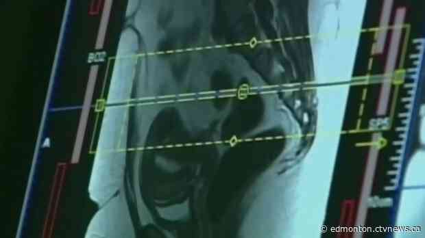 Radiologists ask Albertans to delay non-urgent screenings amid COVID-19