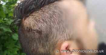 Thug left man with multiple injuries in attack with a knife and a pizza cutter