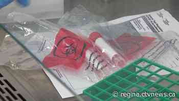 Sask. reporting 17 new COVID-19 cases, provincial total at 44