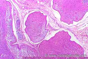 MEK Inhibitor Shrinks Painful Neurofibromas