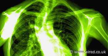 Working from home is ruining your posture. Here’s how to fix it