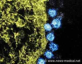 Researchers decode 3D architecture of SARS-CoV-2 main protease - The Medical News