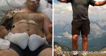 Cyclist suffered catastrophic injuries after slipping on leaves and hitting post