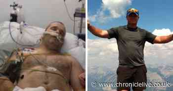 Cyclist suffered catastrophic injuries after slipping on leaves and hitting post