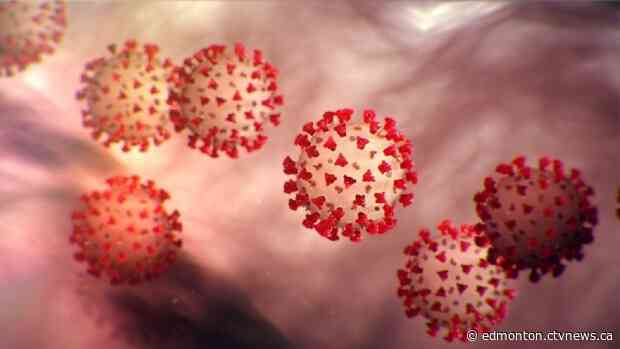 Alberta confirms 42 new COVID-19 cases; total up to 301