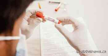 Calgary researcher leads global study to improve diagnosis, treatment for kids with COVID-19