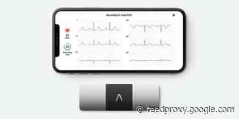 FDA allows AliveCor’s AI ECG to detect coronavirus drug-induced heart problems