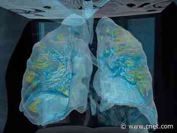 Hospital uses VR to show how coronavirus impacts the lungs     - CNET