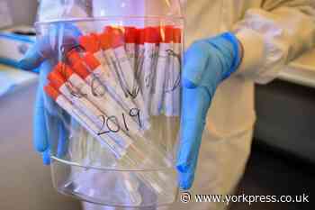 When will I be able to get a test for Covid-19?