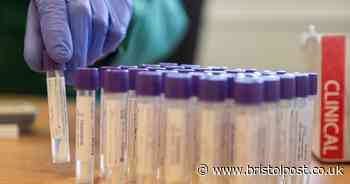 Experts say at home test for coronavirus could be out soon
