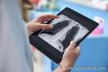 A.I. could help spot telltale signs of coronavirus in lung X-rays