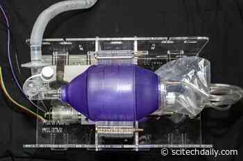 MIT Posts Free Plans Online for an Emergency Ventilator That Can Be Built for $100