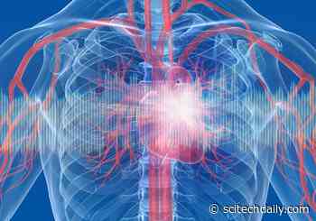 COVID-19 Can Cause Cardiac Injury – Even in Patients Without Underlying Heart Conditions