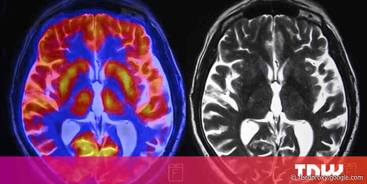 How chronic stress changes the brain — and what you can do to reverse the damage