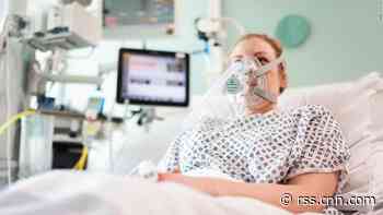 Mercedes F1 engineers help make a breathing aid for coronavirus patients in less than 100 hours
