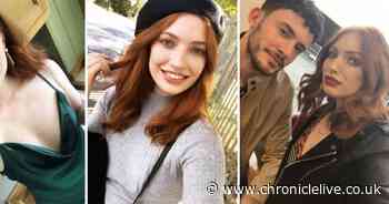 Model with rare condition left fearing for her life amid coronavirus pandemic