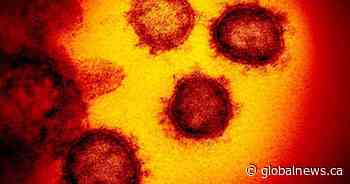 ‘We’ve never seen a virus like this before’: Toronto-area doctor on rapid spread of coronavirus - Global News