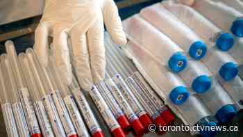 Ontario confirms 401 more cases of COVID-19; provincial total climbs to 2,793