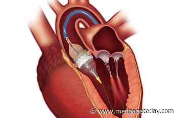 TAVR Newcomers Do Not Solve Access, Geography Problem
