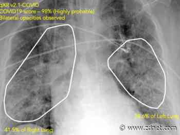 AI runs smack up against a big data problem in COVID-19 diagnosis
