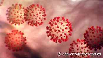 106 new cases of COVID-19 announced in Alberta on Saturday and 2 more deaths