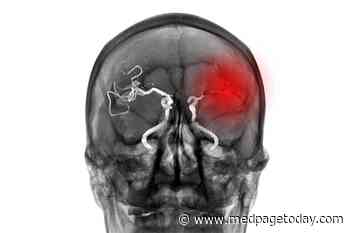 With COVID-19, Stroke Guidelines Now a 'Goal, Not an Expectation'