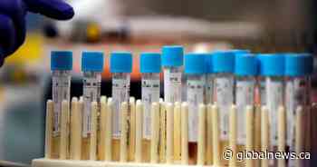 COVID-19 cases in Saskatchewan rise to 249 after 18 new cases reported