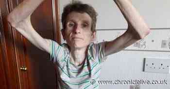 Woman's remarkable recovery after being hit by van and having leg amputated