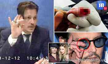 Johnny Depp jokes his severed finger gushed after it was sliced off during a fight with Amber Heard 