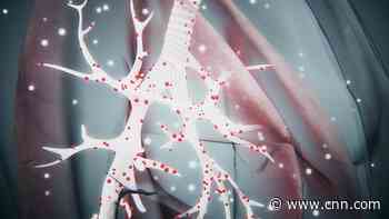 Coronavirus symptoms: 10 key indicators and what to do