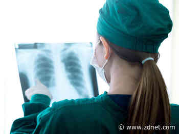 Open-source AI tool aims to help identify coronavirus infections