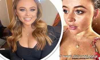 Emily Atack shows off her freckles after sunbathing as she makes the most of the sunny weather