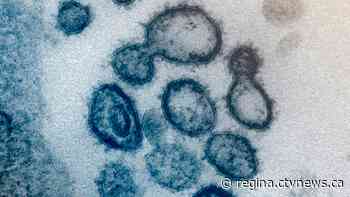 7 new COVID-19 cases in Sask., 21 more recoveries