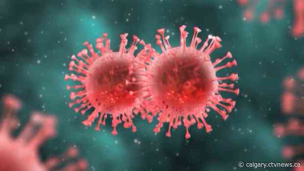 1 more death from COVID-19 in Calgary Zone, 69 new cases of the illness in Alberta