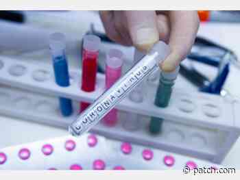 Medical Experts Blast Calif. Coronavirus Herd Immunity Theory - Palo Alto, CA Patch